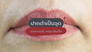 ปากดำเป็นจุด
